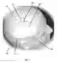 Fig. 02 - Method of manufacturing a medical device for external application to the head of a patient