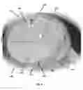 Fig. 03 - Method of manufacturing a medical device for external application to the head of a patient