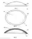 Fig. 04 - Method of manufacturing a medical device for external application to the head of a patient