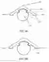 Fig. 04 - Ice cap for electric cable