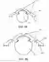 Fig. 07 - Ice cap for electric cable