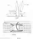 Fig. 16 - Track and seat adapter for positioning and locking wheelchairs and transit seats