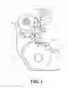 Fig. 02 - Vehicle disc brake