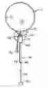 Fig. 01 - Multifunctional balloon membrane