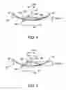 Fig. 04 - Method and apparatus for reducing structural vibration and noise
