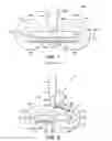 Fig. 02 - Aircraft landing gear assembly