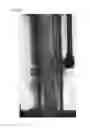 Fig. 04 - AIR DIFFUSER AND MEMBRANE BIO-REACTOR