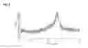 Fig. 06 - Solid Forms Of A Transthyretin Dissociation Inhibitor