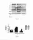 Fig. 04 - Method for preventing and/or treating a subject suffering from asthma