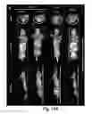 Fig. 18 - Probe for imaging PARP-1 activity