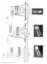 Fig. 04 - Beta sheet tapes ribbons in tissue engineering