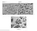 Fig. 07 - Beta sheet tapes ribbons in tissue engineering