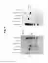 Fig. 11 - NUCLEIC ACIDS FOR TREATMENT OF ALLERGIES