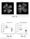 Fig. 10 - Anti-LRP5 antibodies and methods of use