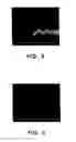 Fig. 04 - ETCHING LIQUID COMPOSITION FOR MULTILAYER CONTAINING COPPER AND MOLYBDENUM AND PROCESS FOR ETCHING THEREOF