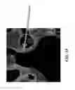 Fig. 20 - Multi-modal beds of coking material