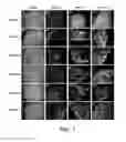 Fig. 02 - Patient-specific stem cell lines derived from human parthenogenetic blastocysts
