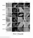 Fig. 03 - Patient-specific stem cell lines derived from human parthenogenetic blastocysts