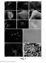 Fig. 06 - Patient-specific stem cell lines derived from human parthenogenetic blastocysts