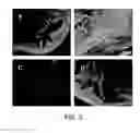 Fig. 07 - Patient-specific stem cell lines derived from human parthenogenetic blastocysts