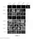 Fig. 09 - Patient-specific stem cell lines derived from human parthenogenetic blastocysts