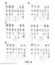 Fig. 11 - Patient-specific stem cell lines derived from human parthenogenetic blastocysts