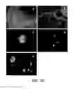 Fig. 12 - Patient-specific stem cell lines derived from human parthenogenetic blastocysts