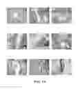 Fig. 13 - Patient-specific stem cell lines derived from human parthenogenetic blastocysts