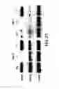 Fig. 23 - Mesoderm and definitive endoderm cell populations
