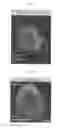 Fig. 02 - Method for producing anterior eye segment tissue