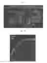 Fig. 07 - Method for producing anterior eye segment tissue