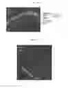 Fig. 08 - Method for producing anterior eye segment tissue