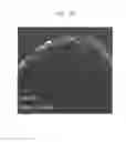 Fig. 09 - Method for producing anterior eye segment tissue
