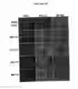 Fig. 04 - Compositions for mesoderm derived ISL1+ multipotent cells (IMPs), epicardial progenitor cells (EPCs) and multipotent C56C cells (C56Cs) and methods of producing and using same