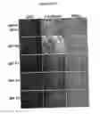 Fig. 05 - Compositions for mesoderm derived ISL1+ multipotent cells (IMPs), epicardial progenitor cells (EPCs) and multipotent C56C cells (C56Cs) and methods of producing and using same