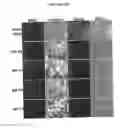 Fig. 06 - Compositions for mesoderm derived ISL1+ multipotent cells (IMPs), epicardial progenitor cells (EPCs) and multipotent C56C cells (C56Cs) and methods of producing and using same