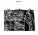 Fig. 08 - Compositions for mesoderm derived ISL1+ multipotent cells (IMPs), epicardial progenitor cells (EPCs) and multipotent C56C cells (C56Cs) and methods of producing and using same