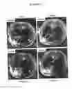 Fig. 44 - Compositions for mesoderm derived ISL1+ multipotent cells (IMPs), epicardial progenitor cells (EPCs) and multipotent C56C cells (C56Cs) and methods of producing and using same