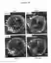 Fig. 45 - Compositions for mesoderm derived ISL1+ multipotent cells (IMPs), epicardial progenitor cells (EPCs) and multipotent C56C cells (C56Cs) and methods of producing and using same