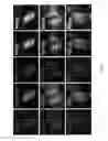 Fig. 05 - Methods for reprogramming differentiated non-cardiac cells into cardiomyocytes
