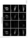 Fig. 19 - Methods for reprogramming differentiated non-cardiac cells into cardiomyocytes
