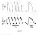Fig. 22 - Methods for reprogramming differentiated non-cardiac cells into cardiomyocytes