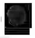 Fig. 04 - Human pluripotent stem cell-based models for predictive developmental neural toxicity