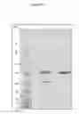 Fig. 13 - Manufacture of active highly phosphorylated human N-acetylgalactosamine-6-sulfatase and uses thereof