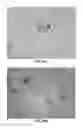 Fig. 22 - Methods and Compositions for the Treatment of Prostate Related Disorders using miR-1
