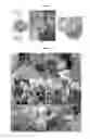 Fig. 05 - PLANTS RESISTANT TO PATHOGENIC MICROORGANISMS GROWING IN VASCULAR TISSUES