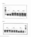 Fig. 06 - Method of quantitatively and qualitatively analyzing biomaterial in real-time