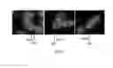 Fig. 04 - Kits for characterization of chromosomal inversions using probes