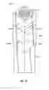 Fig. 09 - Helical pile assembly with top plate