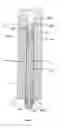 Fig. 07 - Friction bolt assembly